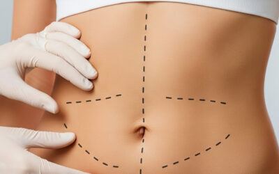 Considering plastic surgery?