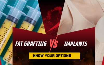 Fat Grafting vs Implants