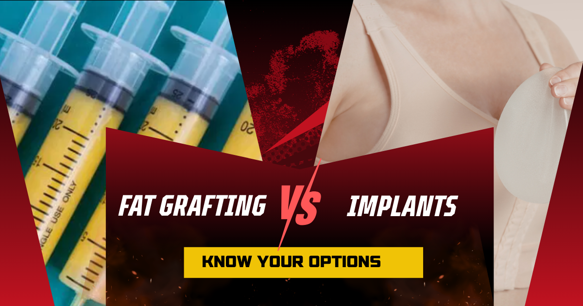 Fat Grafting vs Implants - Know your options, a guide by a plastic surgeon, an image showing comparison fat vs implants